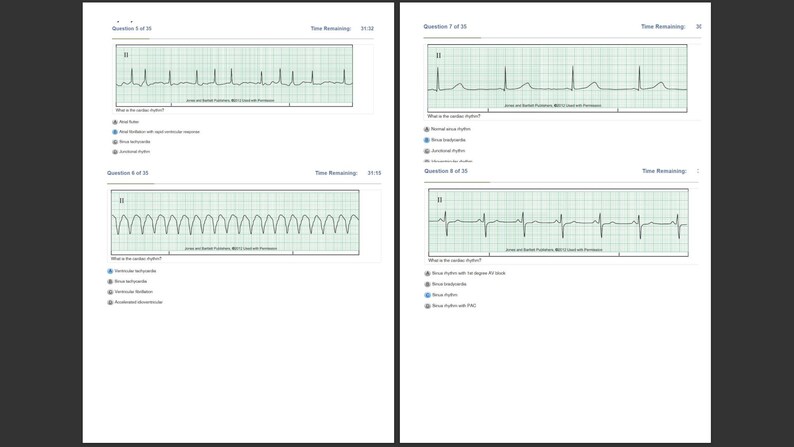 DYSRHYTHMIA BASIC A Questions With Correct Answers - Etsy