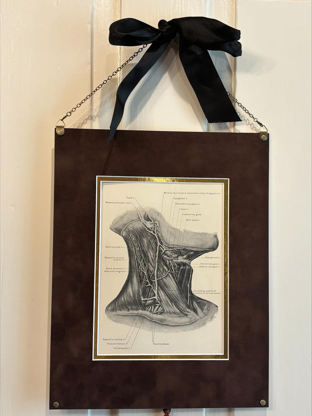 Superficial Structures of Neck — 1904 Original Plate | Antique Medical ...