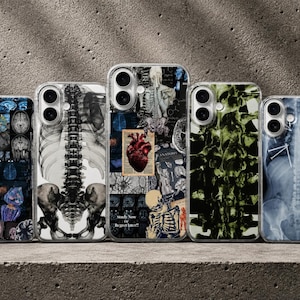 Anatomy Phone Case, X-Ray Skeleton Cover for iPhone 17Pro, 16, 15, 14, 13, 12, Samsung S26, S25, S24, S23, A17, A57, A37 Pixel 10,9