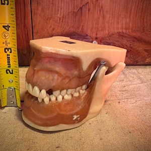 May include: A dental model of a human jaw with teeth, measuring approximately 4 inches in height. The model is made of a flesh-toned material, with white teeth and a metal spring. A yellow measuring tape is next to the model.