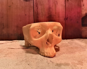 CT-Derived Pediatric Skull Deformity Cast – Medical Oddity Teaching Model