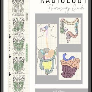 Pode incluir: Um guia educativo de radiologia e fluoroscopia de Arika West com diagramas anatómicos do sistema digestivo humano, incluindo o duodeno, jejuno, íleo e ceco, com uma linha do tempo de imagens e progressão de contraste.