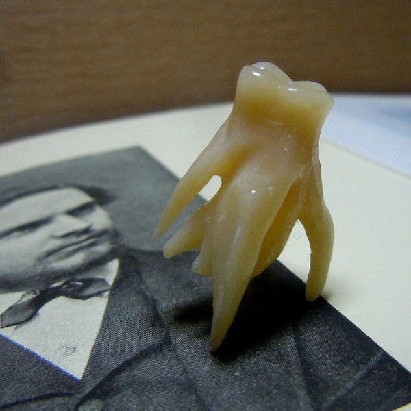 Tooth oddity -Molar with extreme roots