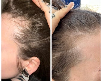 Olio per capelli a base di erbe per una crescita rapida, capelli più forti e folti! Migliora la salute generale dei capelli!