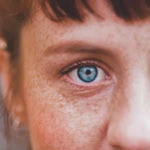 Puede incluir: Primer plano del rostro de una persona, centrado en un ojo azul brillante. La piel es clara y con numerosas pecas. El ojo está abierto y el iris es de un color azul llamativo. La imagen está bien iluminada, mostrando detalles.