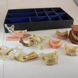 May include: A selection of dental models, including jaw and teeth replicas, presented on a white surface. The models vary in colour, with some showing pink gums and white teeth, while others are brown. A black tray with blue compartments is in the background.