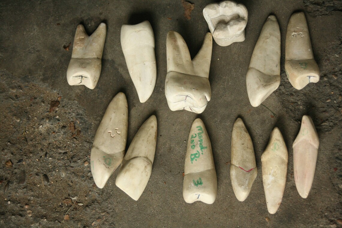 Set of 12 Large Chalk Teeth Teaching Aid Display Dental Etsy