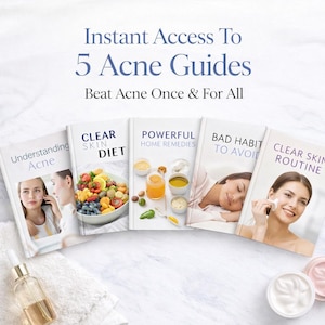 Op de afbeelding: Afbeelding van vijf boeken over acnebehandeling en huidverzorging. De titels zijn "Understanding Acne", "Clear Skin Diet", "Powerful Home Remedies", "Bad Habit to Avoid" en "Clear Skin Routine". Huidverzorgingsproducten zijn ook zichtbaar.