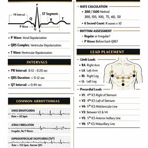 May include: A reference guide for EKG interpretation. The guide includes EKG waveform anatomy, rate and rhythm calculations, and lead placement diagrams. It also features examples of common arrhythmias such as sinus bradycardia and atrial fibrillation.