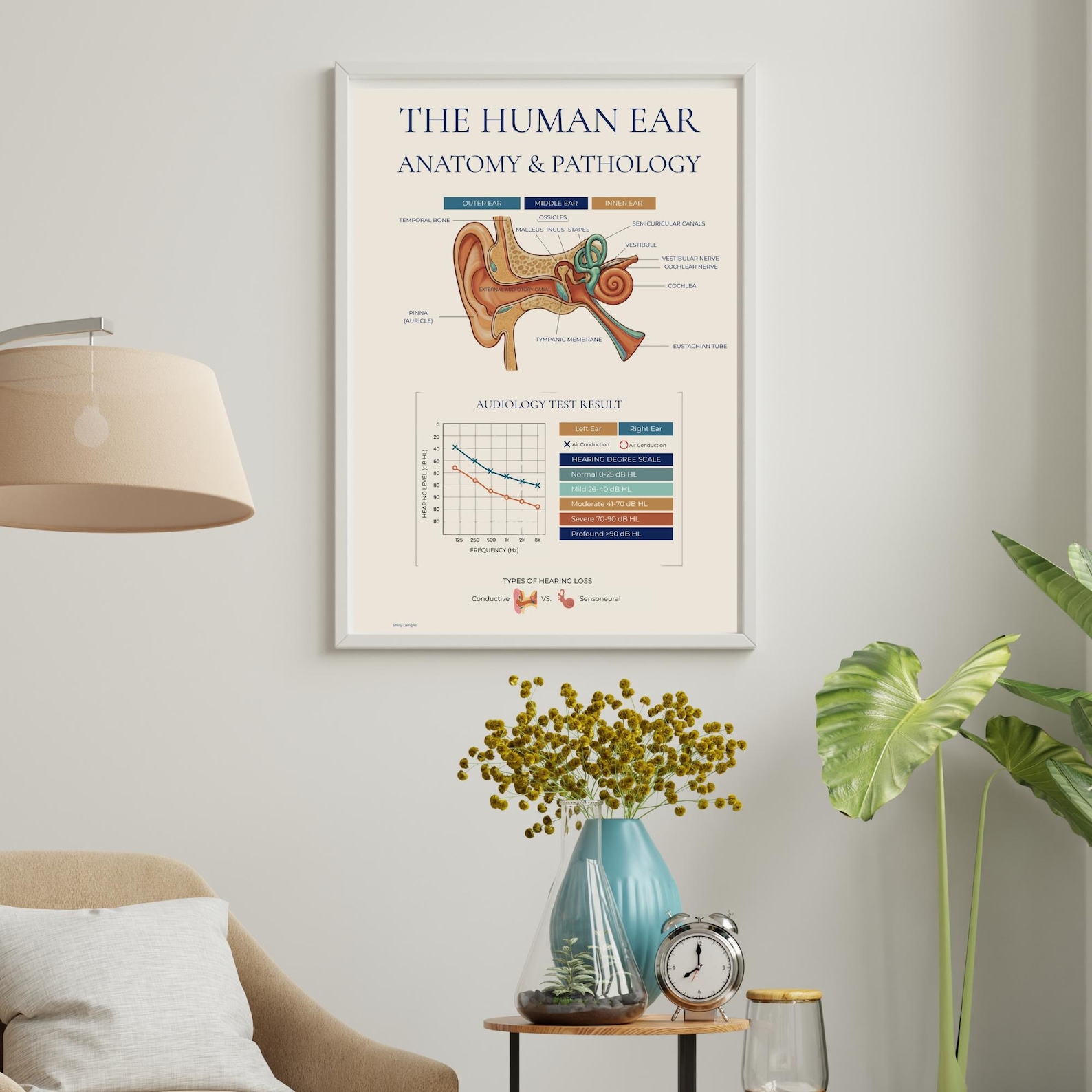 Human Ear Anatomy Pathology Poster, Audiology Audiogram Chart, ENT ...