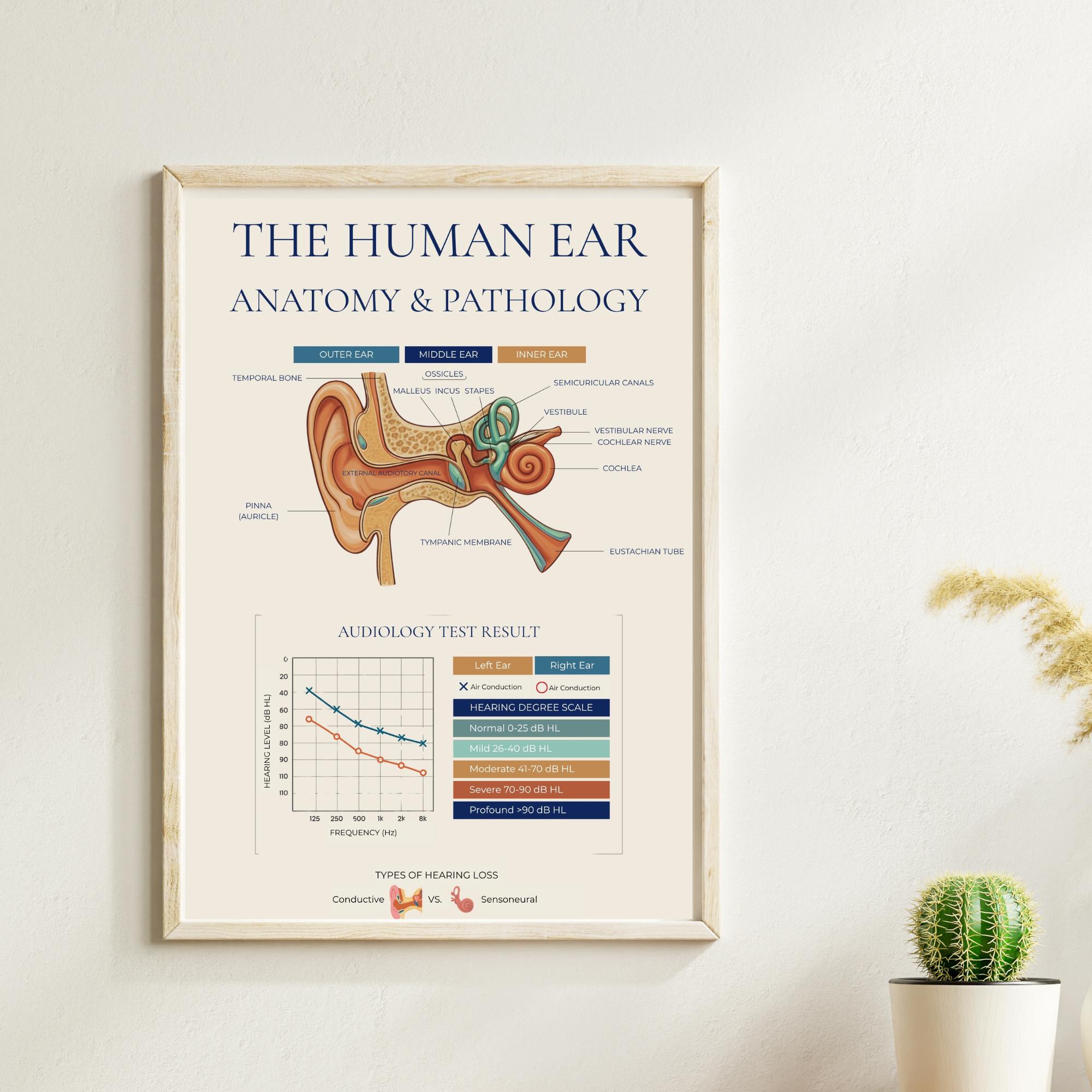 Human Ear Anatomy Pathology Poster, Audiology Audiogram Chart, ENT ...