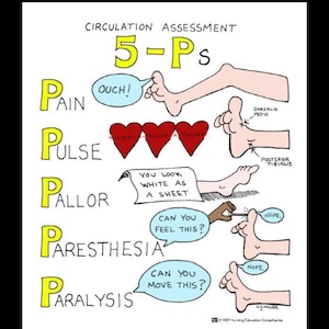 Può includere: Illustrazione medica intitolata "Valutazione della circolazione 5-Ps". L'immagine mostra una gamba con testo e diagrammi. Include le parole "Dolore", "Polso", "Pallore", "Parestesia" e "Paralisi", con indizi visivi.