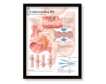 Understanding IBS Framed Medical Educational Informational Poster Diagram Doctors Office School Classroom 22x28 Inches
