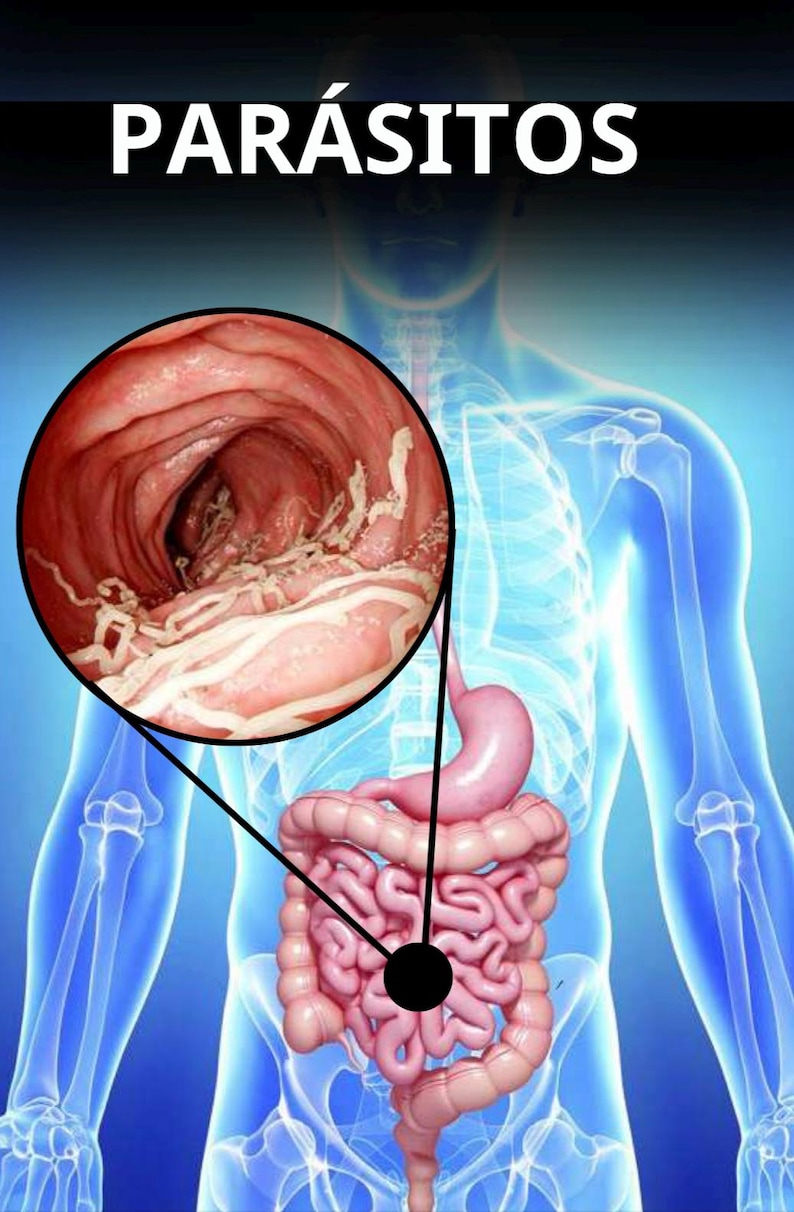 May include: Anatomical illustration of the human digestive system, with a magnified view of the intestinal lining showing parasites. The word "PAR&Aacute;SITOS" is displayed in white text at the top of the image. The image is set against a blue background.