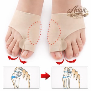 May include: Beige toe separators with a gel pad, designed to align the big toe. The image shows the product in use on feet, with red arrows and diagrams illustrating the before and after effect on the foot's bone structure. The Anas Goods Shop logo is visible.