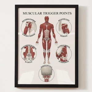 May include: A framed anatomical chart titled "MUSCULAR TRIGGER POINTS." The chart features a detailed illustration of the human muscular system, highlighting various muscle groups and trigger points. The diagram includes labels such as "Pectoralis Minor," "Biceps Tendon," and "Rotator Cuff."