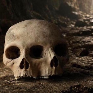 Siamese Triclops Skull – Gothic Curiosity, Museum Style Sculpture - Memento Mori