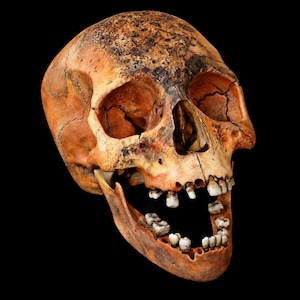 Puede incluir: Un cráneo humano con una textura ósea de color marrón bronceado desgastado y una parte superior oscura y moteada. La mandíbula está en posición abierta, revelando un conjunto de dientes desgastados y descoloridos. Las cuencas oculares son profundas.