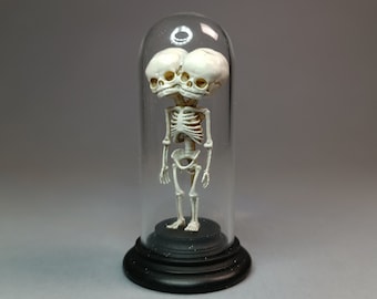 VERBUNDENE TWEENS SKELETON Glaskuppel Miniatur. Dicephalus parapagus dipus Anatomisches Präparat für Puppenhäuser 1:12