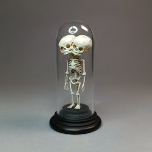 CONJOINED TWINS SKELETON glass dome miniature. Dicephalus parapagus dipus anatomical specimen  for dollhouses 1:12 scale