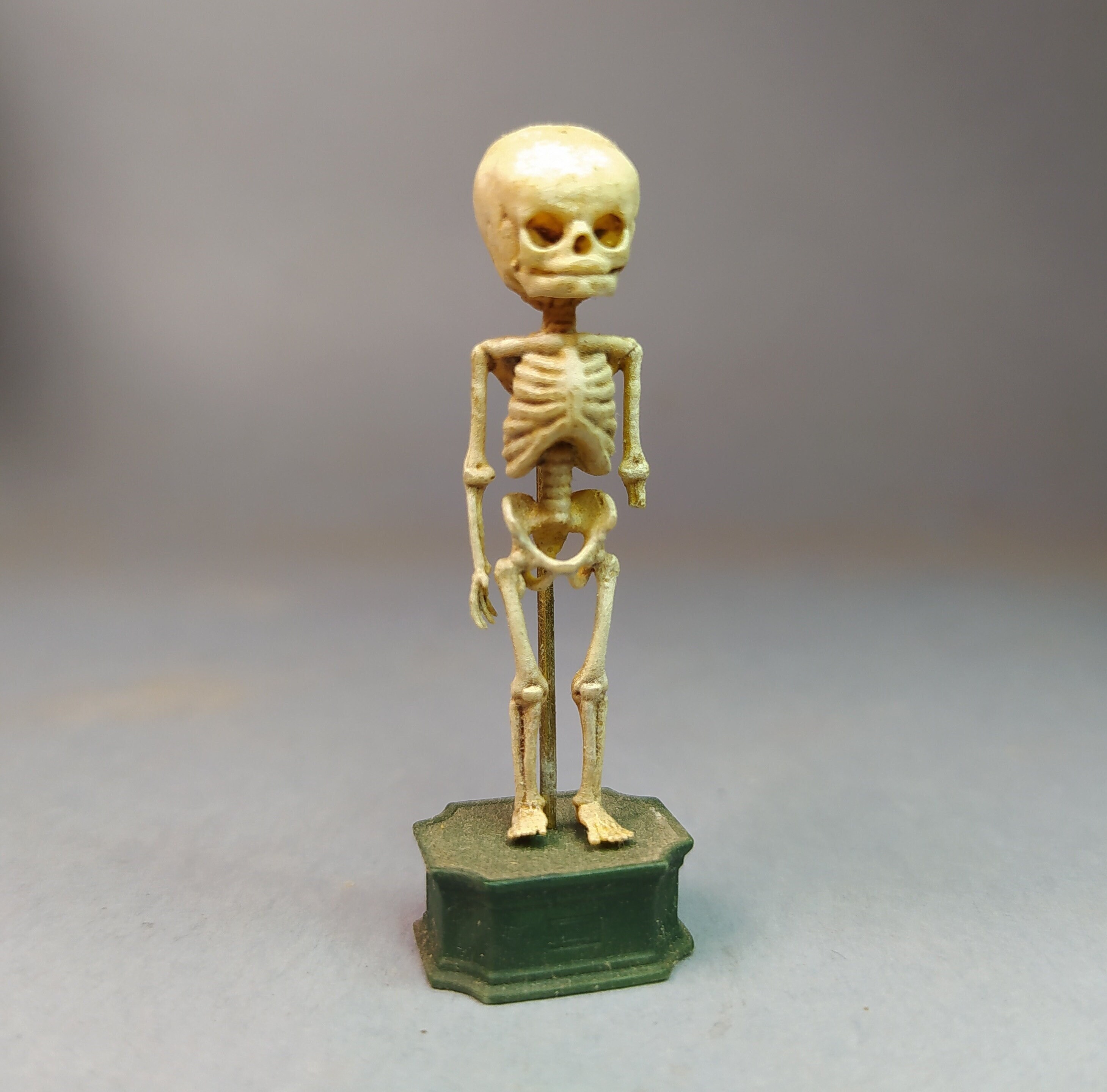CONJOINED TWEENS SKELETON. Dicephalus Parapagus Dipus Anatomical Specimen  Reproducction. Medical Study Miniature for Dollhouses 1:12 Scale 