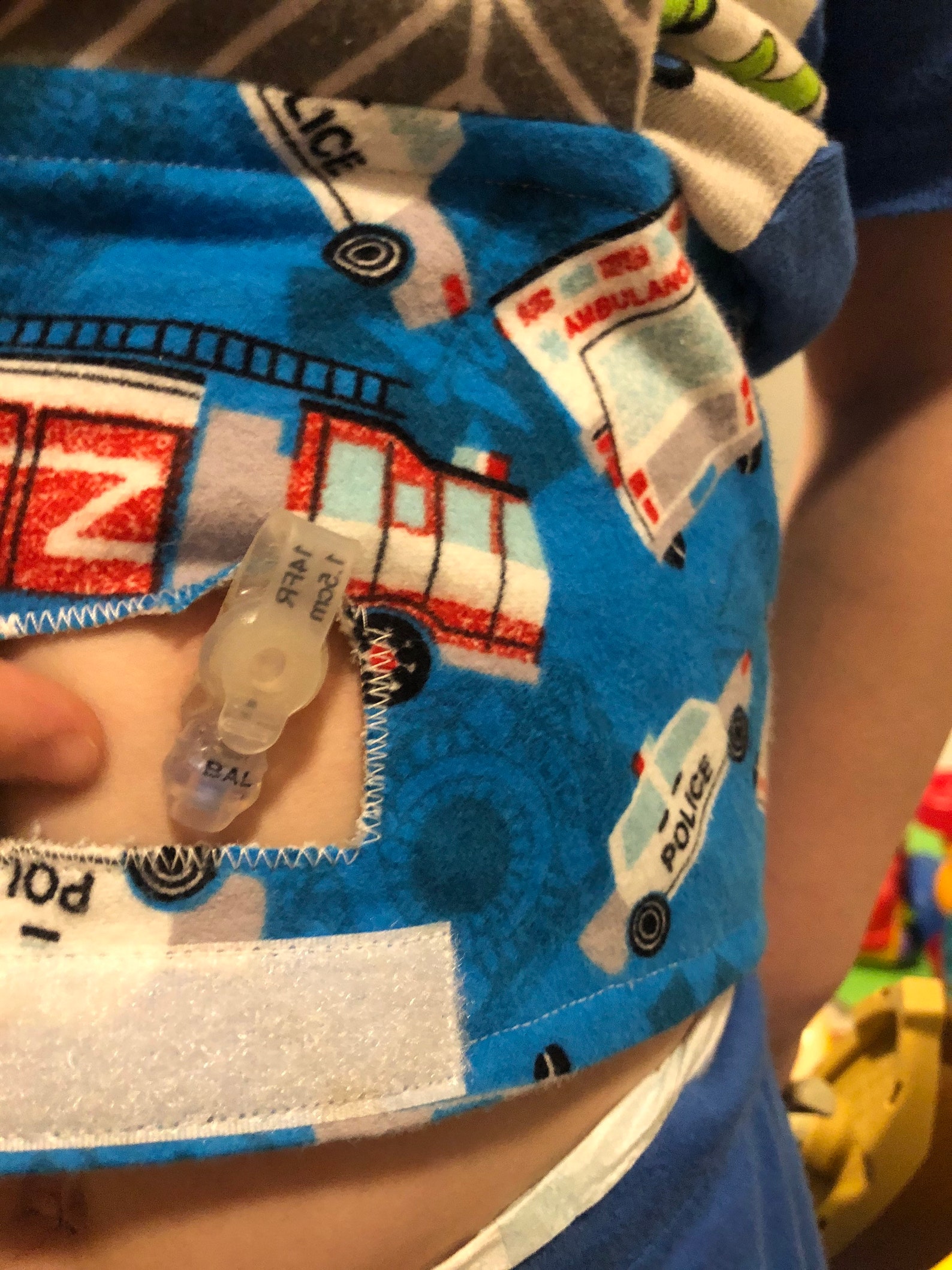 Gtube Belt Feeding Tube Accessories Boys Gtube Belt Girls Etsy