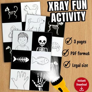 XRAY lustige Aktivität | Körper Struktur Spiel | Lernübung für Kleinkinder (PDF Download)