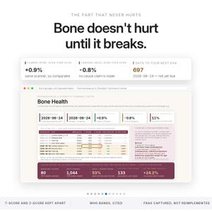 May include: A digital dashboard titled Perimenopause & Strength Command Center displaying bone health data, T-scores, and Z-scores. The text reads: Bone doesn't hurt until it breaks. It includes scan logs, dates, and various health metrics in a table.