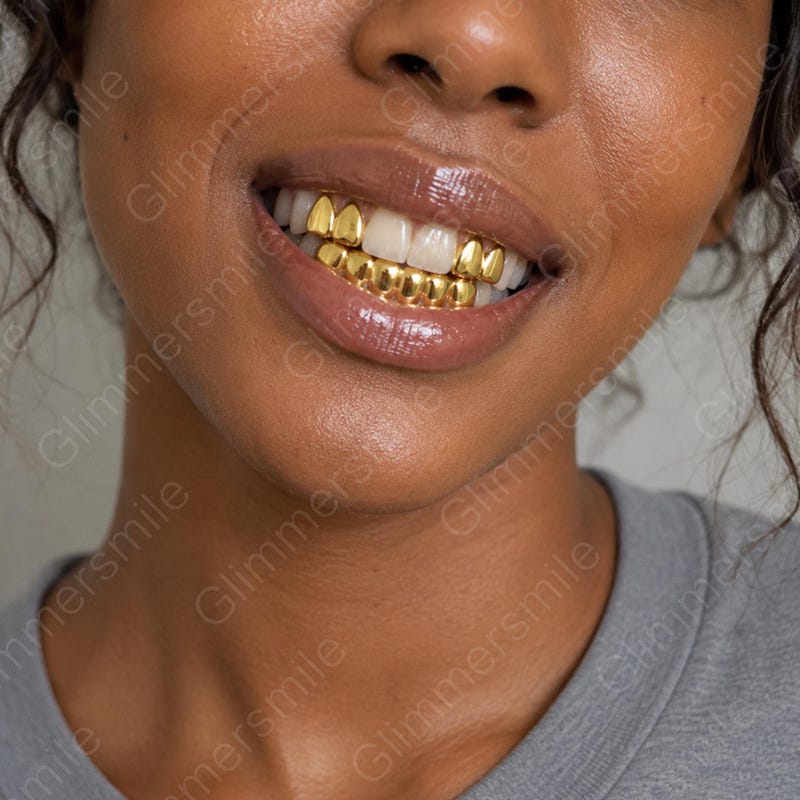 Snap on Gold Teeth - Etsy