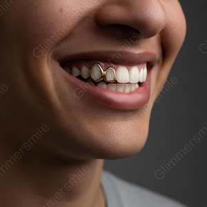 Op de afbeelding: Close-up van een glimlach, met gouden tandgrills op de boventanden. De grills hebben een glanzend, reflecterend oppervlak, dat contrasteert met de natuurlijke witte tanden. De afbeelding is goed belicht, waardoor de details van het gebitwerk worden benadrukt.