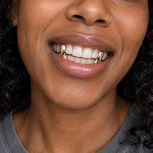 May include: A set of gold-colored tooth caps shaped like fangs, worn over the upper and lower canine teeth. The metallic fangs have a smooth, polished finish and are fitted securely over the natural white teeth, creating a pointed, sharp appearance.