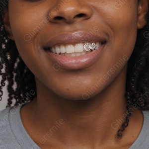 Può includere: Primo piano di una persona che sorride, mostrando una griglia per denti argentata. La griglia presenta un design ornato e a spirale. Le labbra della persona sono leggermente socchiuse, rivelando denti bianchi e uno scorcio delle gengive.