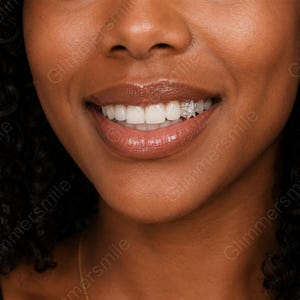 May include: Close-up of a smiling person with bright white teeth. A star-shaped tooth gem is affixed to one tooth. The person's lips are glossy and a gold chain is visible.