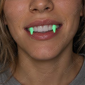 Könnte beinhalten: Ein Paar leuchtend neongrüne Vampirzähne, die über den oberen Eckzähnen platziert sind. Die Fangzähne sind spitz und leuchten in einer kräftigen, hellen Farbe, die einen Kontrast zu den natürlichen weißen Zähnen und den rosa Lippen bildet.