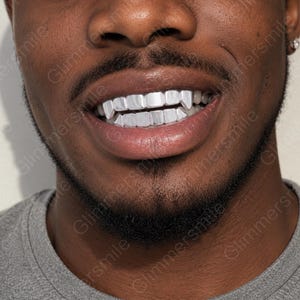 Peut inclure: Un ensemble de grilles dentaires de couleur argentée recouvrant les dents supérieures et inférieures. Le design présente des canines pointues ressemblant à des crocs, avec une finition métallique lisse sur la surface avant. Le mot Glimmersmile est visible.