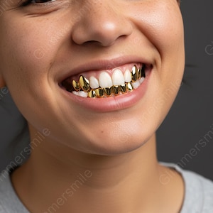 Solides und hohles Grillz-Set | Premium goldfarbene Zahnkappen für oben und unten | Handgefertigter Hip Hop Schmuck | Custom Fit Streetwear Mundstück