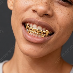 May include: Close-up of a person's mouth with gold-colored teeth grillz. The grillz are custom-fitted and cover the top and bottom teeth. The teeth grillz have a shiny, reflective surface.