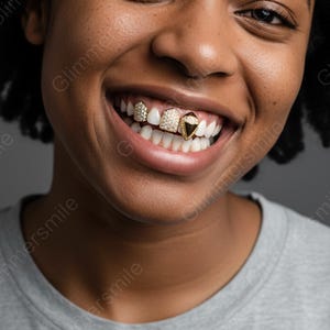 May include: Close-up of a smiling person wearing gold-colored dental grills. The grills feature a diamond-shaped design with a black center and are encrusted with small, sparkling gems. The teeth are white and healthy-looking.