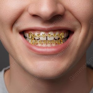 Gouden ster Grillz vlindertanden sieraden set, 18K vergulde open grillz hiphop tandkapjes voor mannen vrouwen, kerstfeest festival sieraden