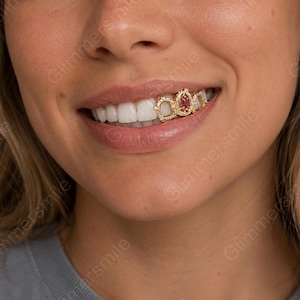 May include: A close-up of a person's smile, showcasing gold teeth grillz. The grillz feature a central ruby gemstone, surrounded by smaller clear stones, and are set in a gold frame. The teeth are white and the lips are a natural pink.
