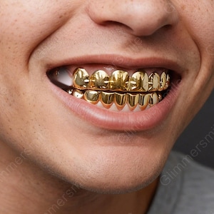 May include: Close-up of a person's mouth displaying gold teeth. The gold teeth are a full set, covering both the upper and lower teeth. The teeth have a shiny, reflective surface, and the gums are visible.