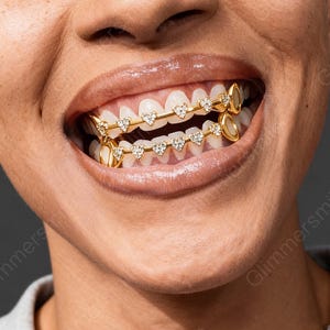 Può includere: Primo piano della bocca sorridente di una persona con griglie per denti color oro. Le griglie presentano gemme a forma di cuore e sono progettate per adattarsi ai denti superiori e inferiori. I denti sono bianchi e le labbra lucide.