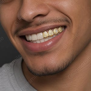 May include: Close-up of a person smiling, showcasing gold teeth that spell out the name "NICK". The gold teeth are custom-made and fit over the natural teeth. The person has a mustache and a short beard.