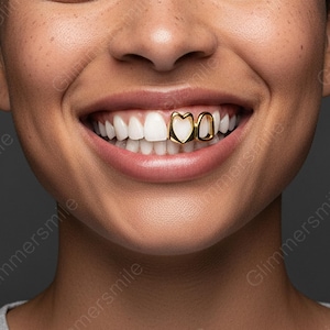 May include: A close-up of a smiling person's mouth, displaying gold-coloured teeth grillz. The grillz have a heart design. The person has white teeth and pink lips. The background is a blurred, neutral colour.
