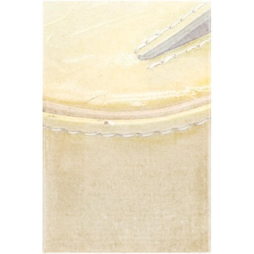 Louis Vuitton Fulton Vernis Yellow Patent Leather Bum Bag image 7
