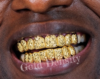 Puede incluir: Primer plano de la boca de una persona con grillz dorados. Los grillz tienen un patrón texturizado en forma de diamante. El texto "Gold Density" es visible en el labio inferior.