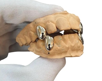 Puede incluir: Un conjunto de fundas dentales de oro pulido ajustadas sobre un molde dental de color beige. Las cubiertas metálicas tienen forma para adaptarse a los dientes individuales, mostrando una superficie lisa y reflectante sobre el material mate.