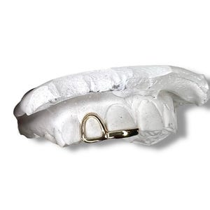 May include: A gold-colored tooth grill, resting on a white dental mold. The grill has a simple, open design. The dental mold is white and shows the impression of teeth.