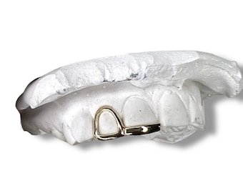 Puede incluir: Una rejilla dental dorada, apoyada sobre un molde dental blanco. La rejilla tiene un diseño simple y abierto. El molde dental es blanco y muestra la impresión de los dientes.