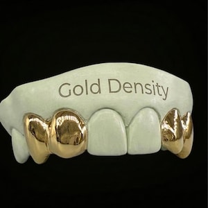 Op de afbeelding: Een goudkleurige tandgrill met de tekst "Gold Density" gegraveerd op de bovenkant. De grill heeft gouden kappen op de voortanden en staat tegen een zwarte achtergrond.